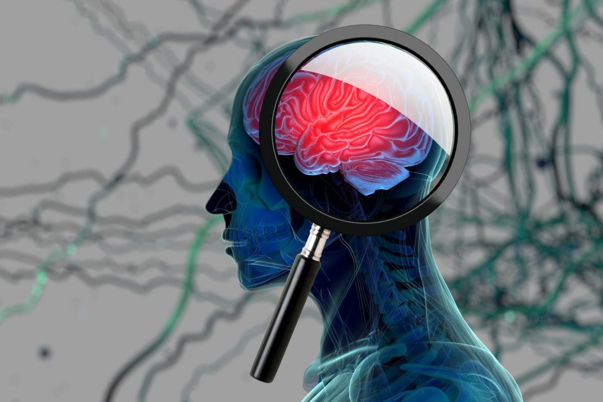 Intracerebral Hemorrhage Outcomes and Related Clinical Conditions