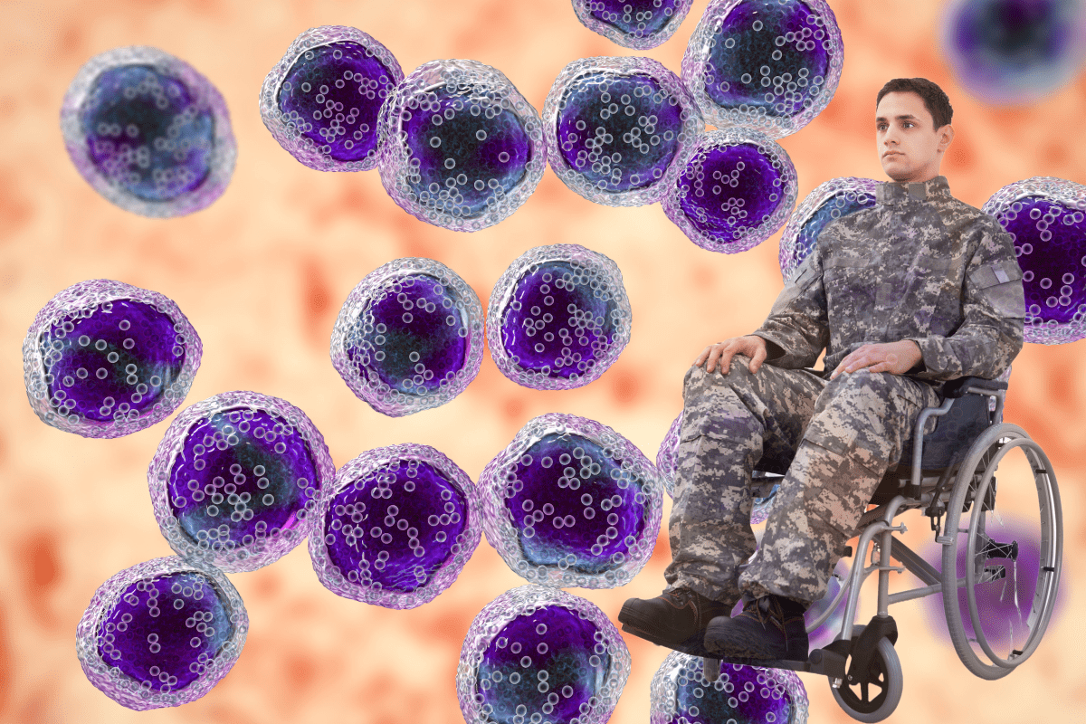 Epstein Barr Virus Linked to Multiple Sclerosis, Compelling Evidence Suggests